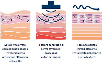 radiofrequenza noleggio e vendita Wellness Project Group
