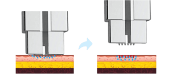 funzionamento-v-system